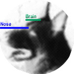 Nose-Brain